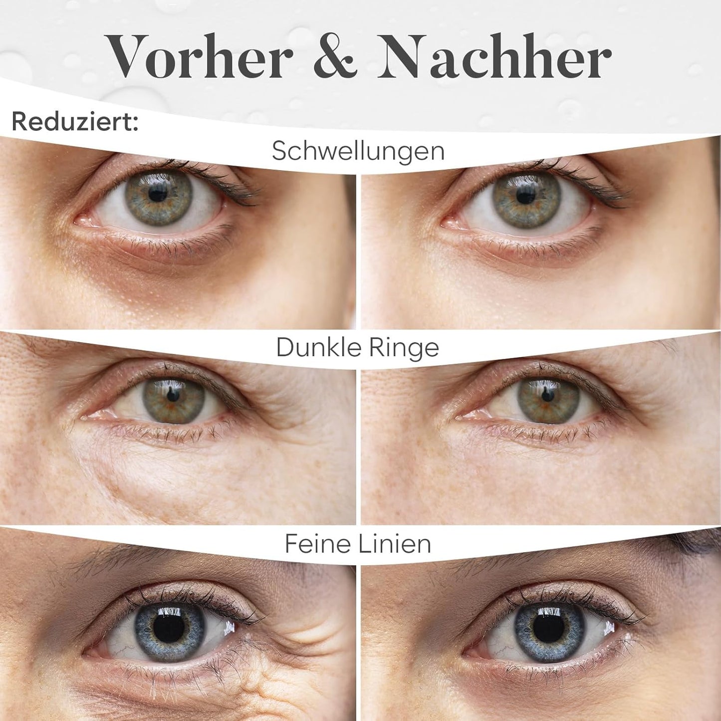 BLOOMORA Mixed Eye Pads (30 Pairs) | Eye Pads with Niacinamide & Eye Pads Hyaluronic | Eye Pads Against Dark Circles | Remove Dark Circles | Eye Patches