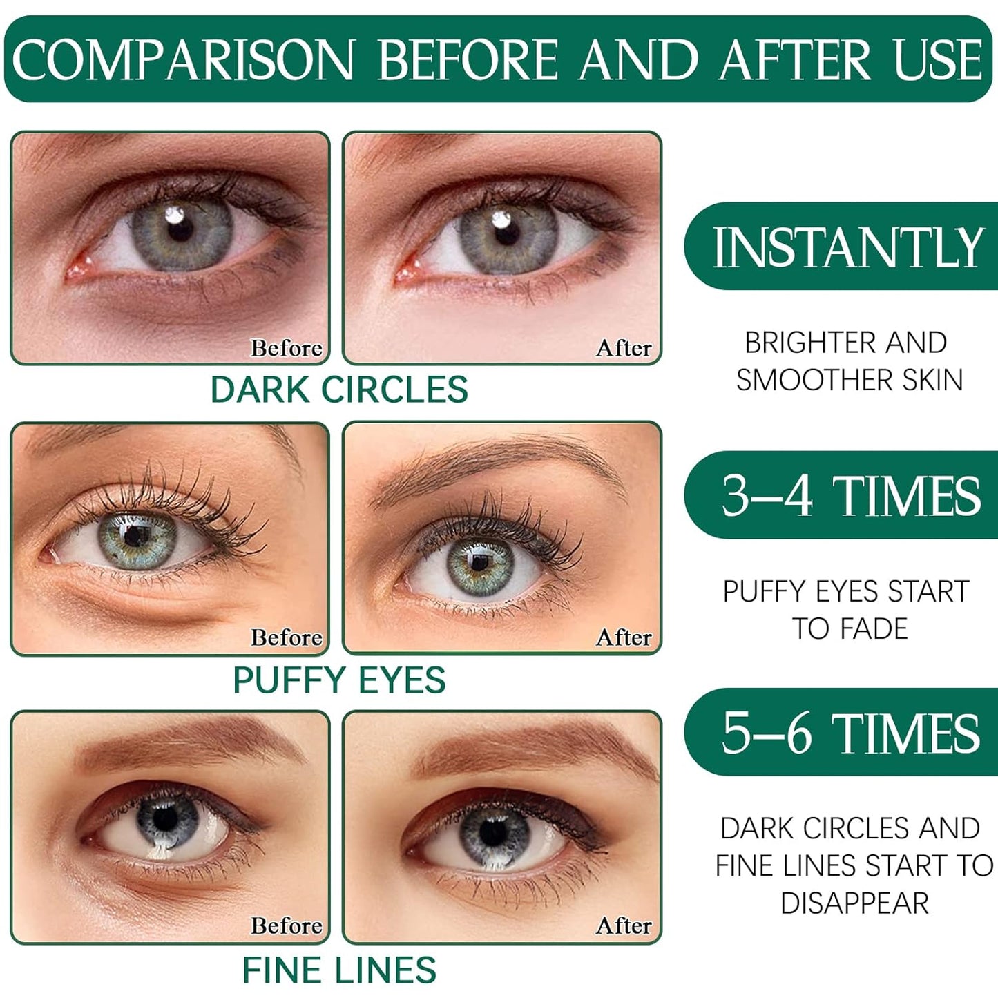 Eye Pads, 60 Pieces Eye Pads, Collagen Eye Pads Against Dark Circles with Aloe Vera, Hyaluronic Acid Eye Mask, Dark Circles Removal, Wrinkles, Eye Bags, Puffiness (Green)